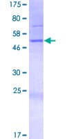 Human KIAA1641 Protein (Recombinant GST)