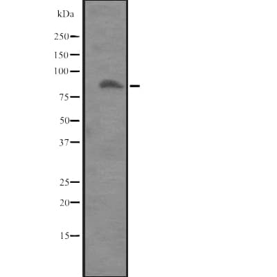 ITGB8 / Integrin Beta 8 Antibody