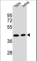 ADA / Adenosine Deaminase Antibody (aa287-314)