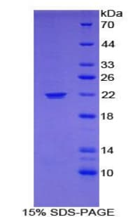 Mouse MAOA / Monoamine Oxidase Protein (Recombinant His)