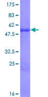 Human TMED1 / ST2L Protein (Recombinant GST)