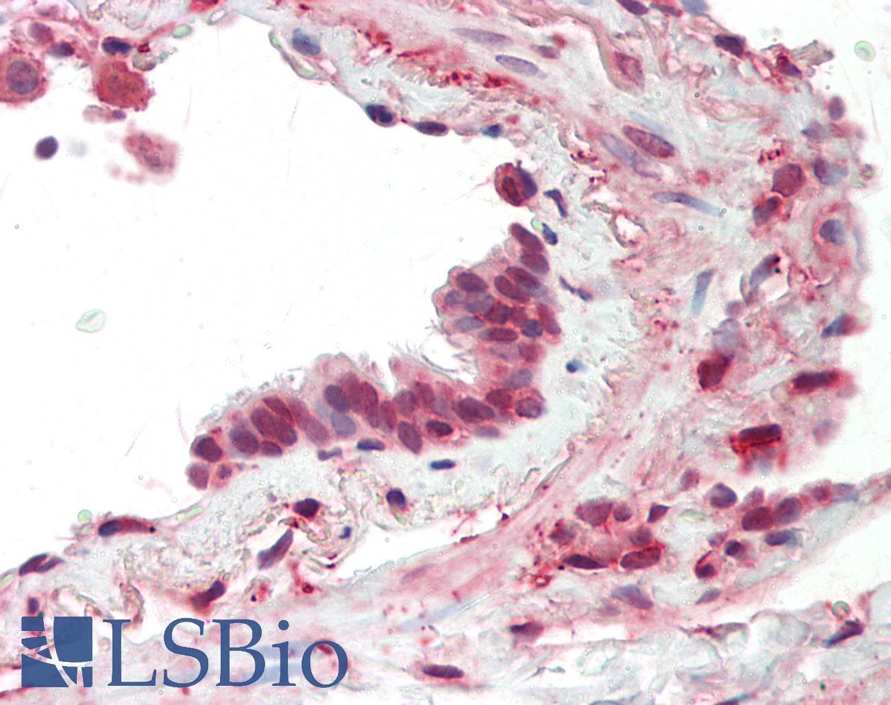 Polyclonal Rabbit anti-Human MCAM / CD146 Antibody (aa289-338, IHC, WB)