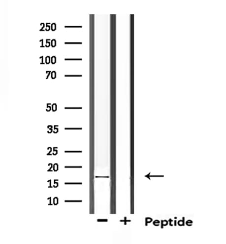 TRAPPC1 / MUM2 Antibody