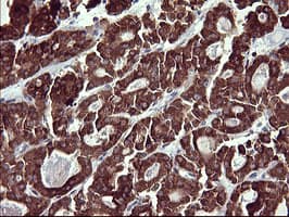 MMP13 Antibody (aa104-471, clone OTI2D8)