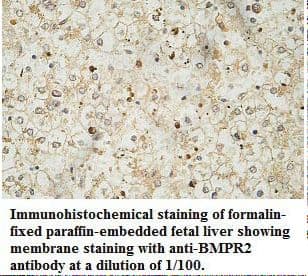 BMPR2 Antibody (aa295-552)