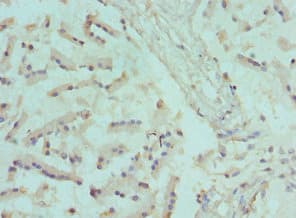 Polyclonal Rabbit anti-Human CANT1 Antibody (aa102-401, IHC)