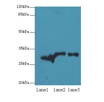 ETHE1 Antibody