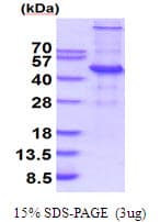 Human UBE2Q2 Protein (Recombinant His)
