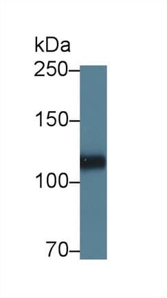 HSPG2 / Perlecan Antibody (aa4149-4391)
