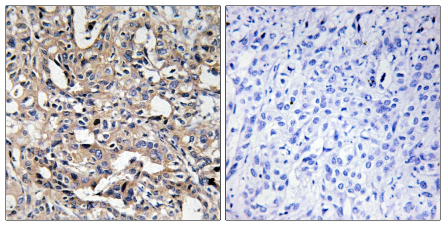 BAX Antibody