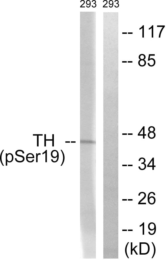 TH / Tyrosine Hydroxylase Antibody (phospho-Ser19)