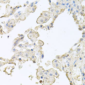 MMRN1 Antibody