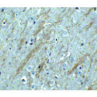 BACE1 / BACE Antibody