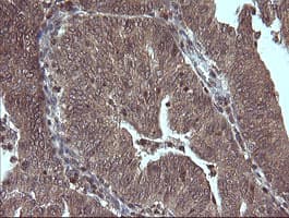 Monoclonal Mouse anti-Human MAP2K3 / MEK3 / MKK3 Antibody (clone OTI1H6, IHC, IF, WB)