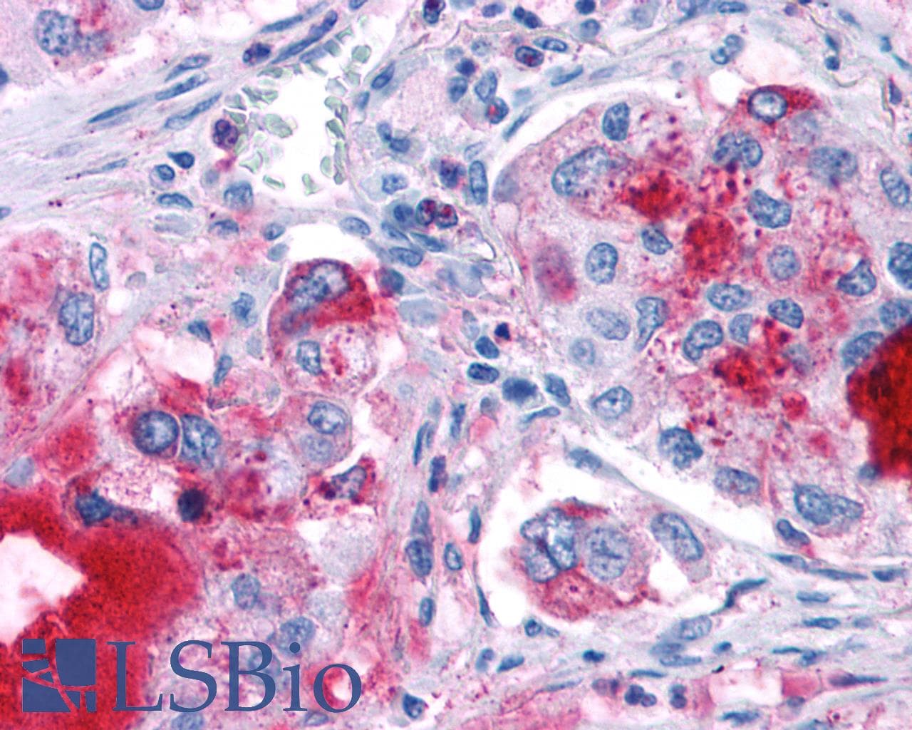 PathPlus™ GPR82 Antibody (Cytoplasmic Domain)