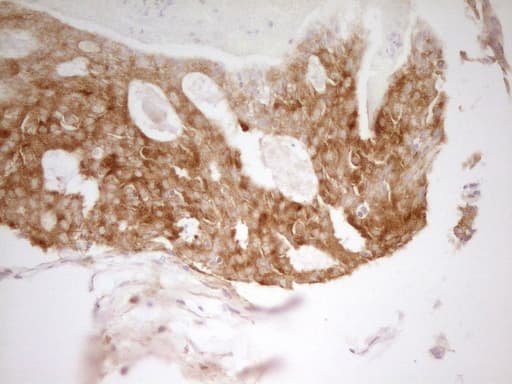 Monoclonal Mouse anti-Human PAK4 Antibody (clone OTI1C7, aa1-308, IHC, WB)