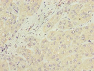 NUBPL Antibody