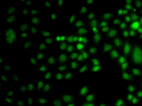 Polyclonal Rabbit anti-Human TRPS1 Antibody (IF, WB)