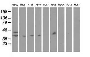 Monoclonal Mouse anti-Human HP / Haptoglobin Antibody (clone OTI4H5, IF, WB)
