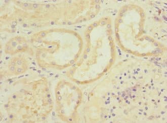 Polyclonal Rabbit anti-Human ADAM19 Antibody (IHC)