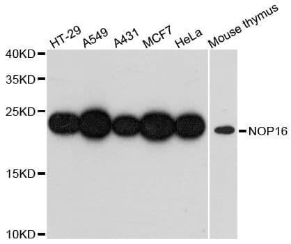 NOP16 Antibody