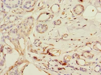 PDE6D / PDE6 Delta Antibody