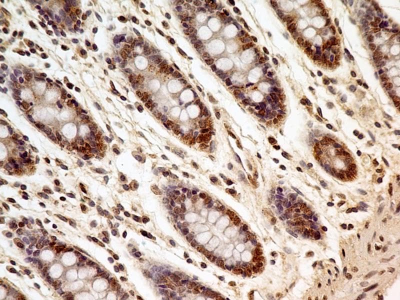 FOXP1 Antibody (clone JC12)