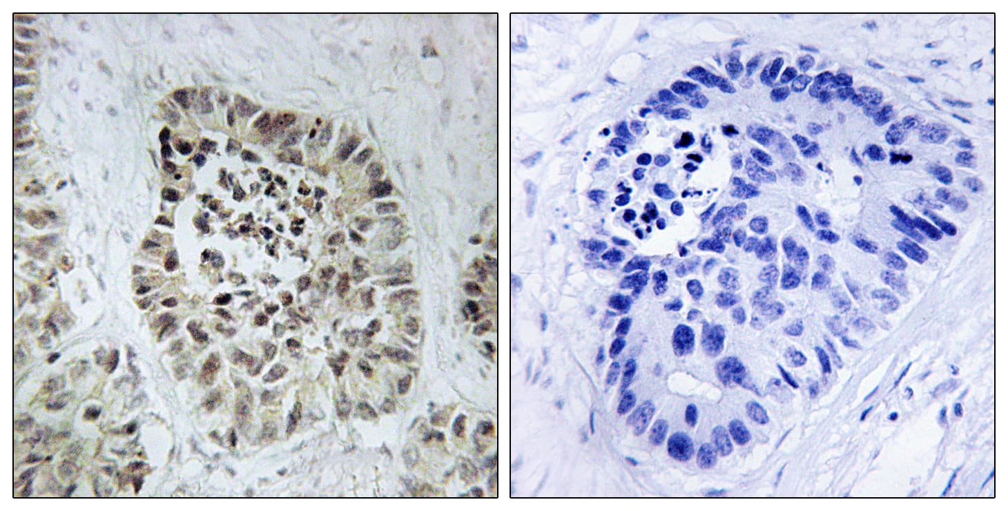 DCLRE1C / Artemis Antibody (aa482-531)