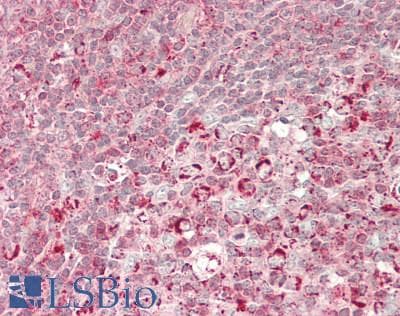 FGF17 Antibody (aa85-134)