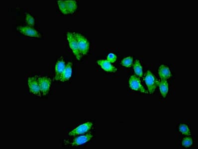 PANK1 / PANK Antibody