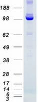 Human BUB1B / BubR1 Protein (Recombinant Myc-DDK (Flag))