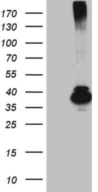 HFE2 / Hemojuvelin Antibody (aa36-263, clone OTI4E2)