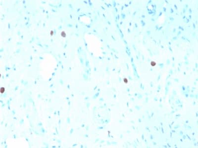 HPV16 L1 Antibody (clone rHPV16L1/1058)
