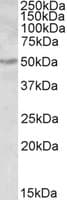 IHC-plus™ Polyclonal Goat anti-Human ALDH9A1 Antibody (aa297-311, IHC, WB)