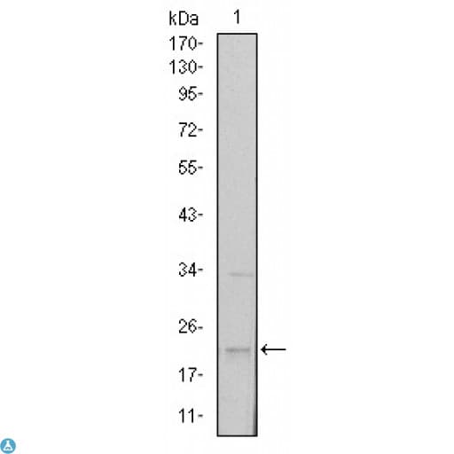 SNAI1 / SNAIL-1 Antibody