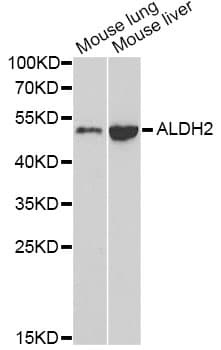 Polyclonal Rabbit anti-Human ALDH2 Antibody (IHC, IF, WB)
