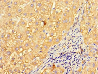 INVS / Inversin Antibody