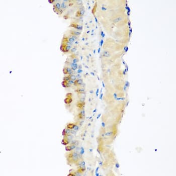 MSTN / GDF8 / Myostatin Antibody