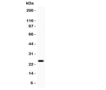 PRL / Prolactin Antibody (aa29-227)