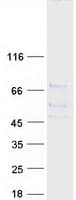Human EXTL1 Protein (Recombinant Myc-DDK (Flag))