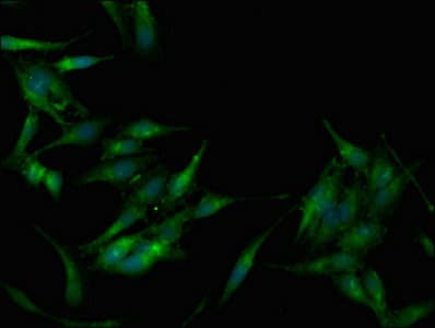 PRKAB1 / AMPK Beta 1 Antibody