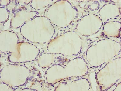 ALAS2 Antibody