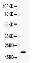 GADD45A / GADD45 Antibody