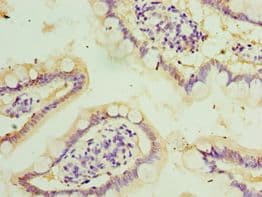 Polyclonal Rabbit anti-Human STAU2 Antibody (aa1-100, IHC)