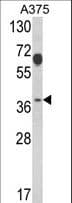 Polyclonal Rabbit anti-Human PSMD7 / MOV34 Antibody (aa6-34, IHC, WB)