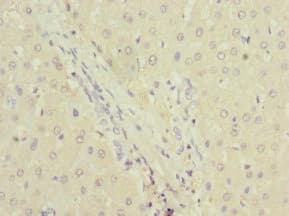 Polyclonal Rabbit anti-Human DPYS / Dihydropyrimidinase Antibody (IHC, WB)