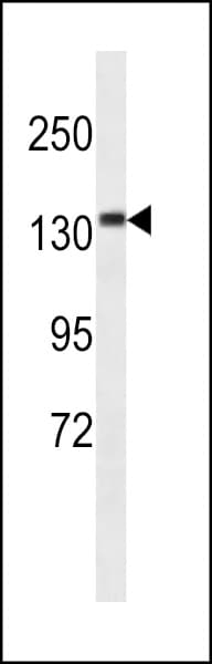 CAMSAP3 / KIAA1543 Antibody (aa103-131)