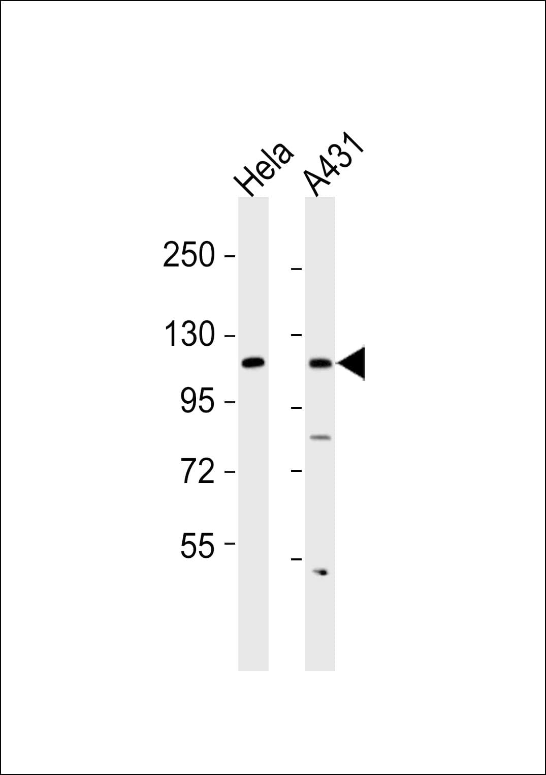 COL1A2 / Collagen I Alpha 2 Antibody