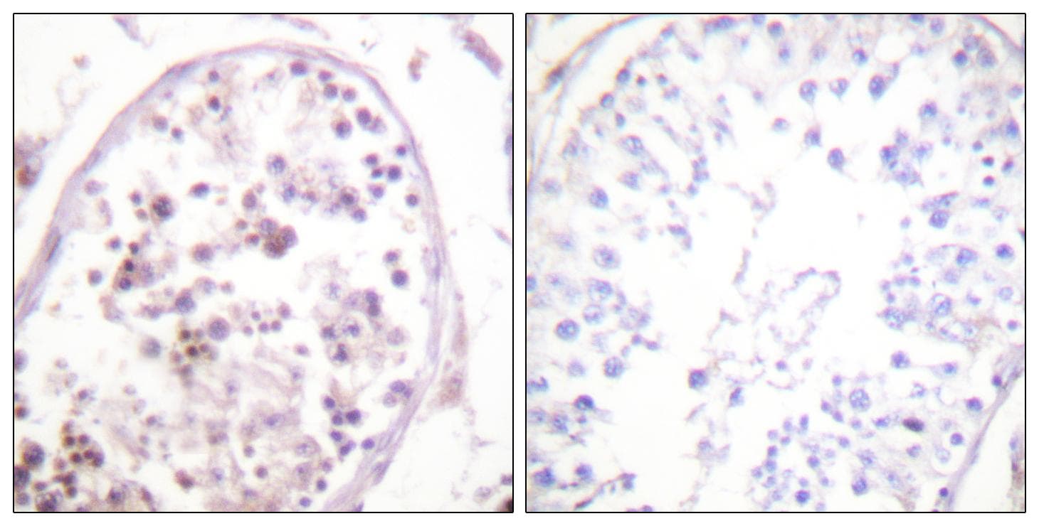 Polyclonal Rabbit anti-Human HDAC6 Antibody (Ab-22, IHC, IF, WB)