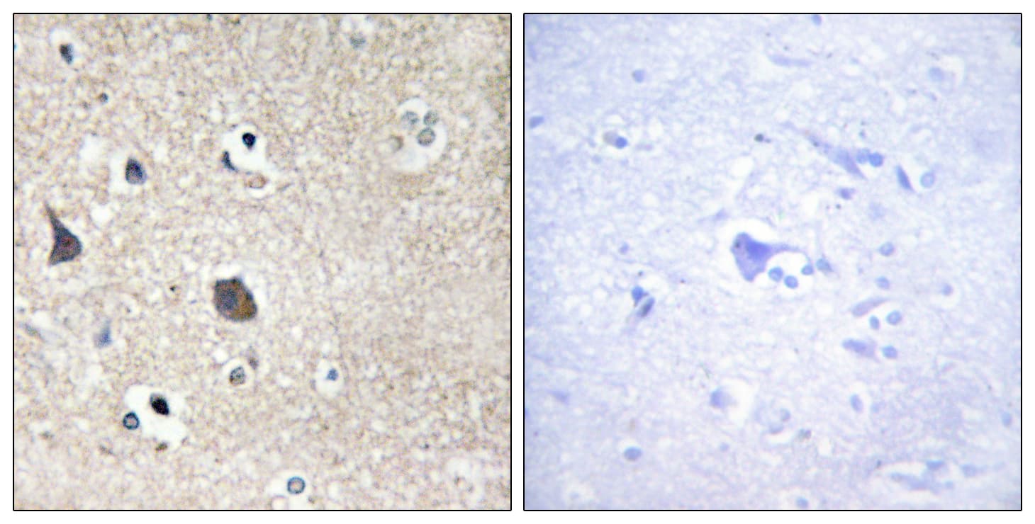 MID1 Antibody (aa71-120)